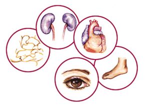 Organs for which diabetes mellitus complications